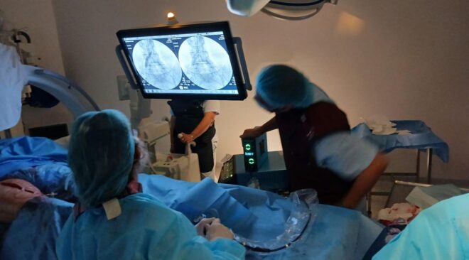 PRIMER LITOTRICIA ENDOVASCULAR DEL INTERIOR DEL PAÍS SE REALIZÓ EN SAN JOSÉ